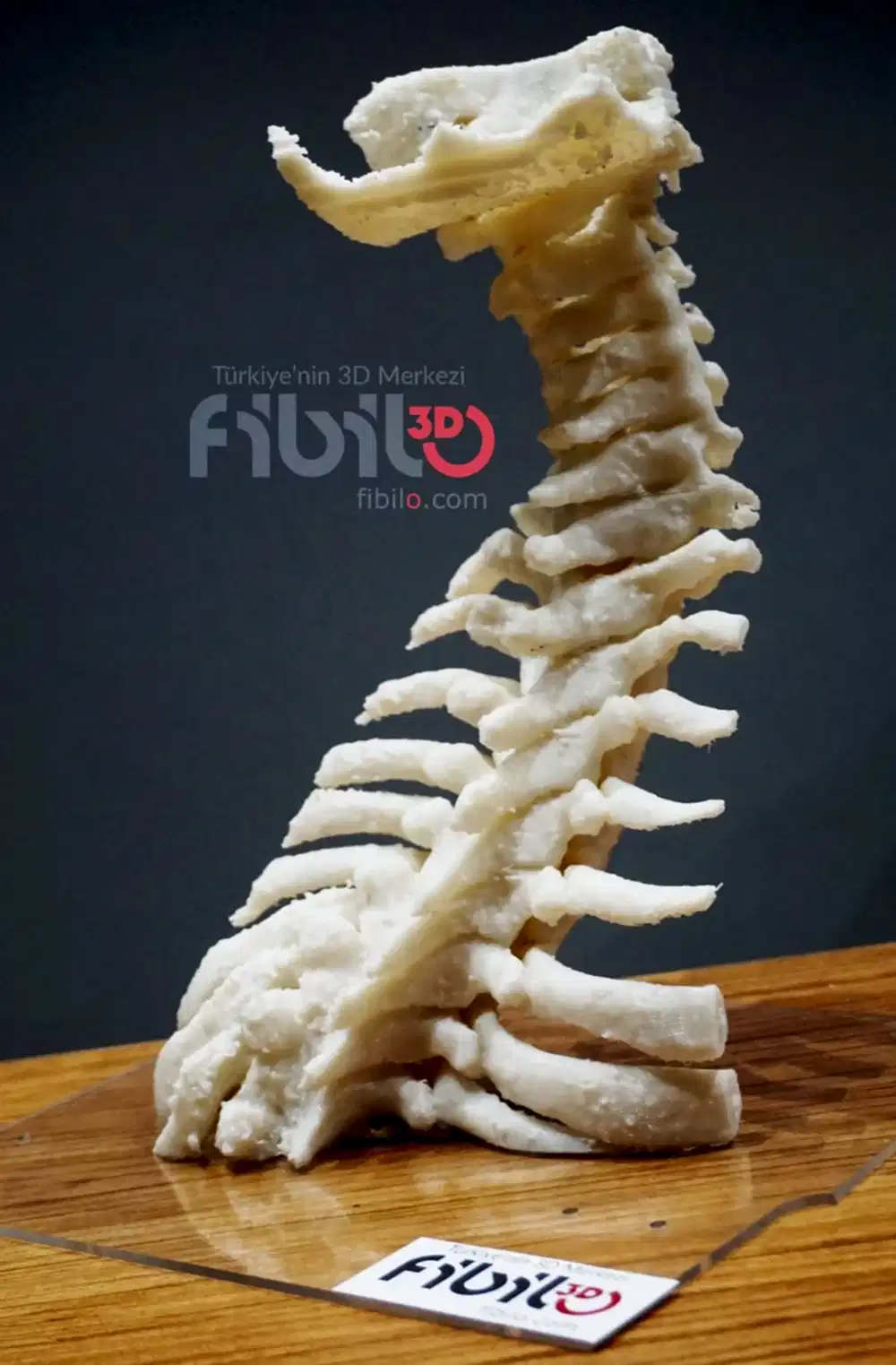 kemik 3d baskı